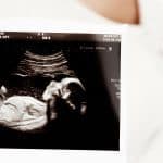 additional antenatal scans