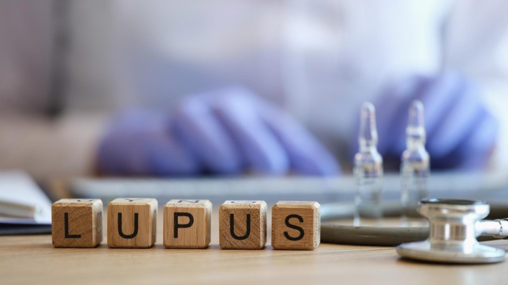 understanding lupus